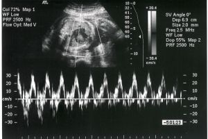 Canine Gestation